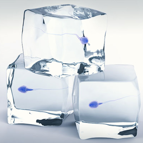 Freezing of Sperm
